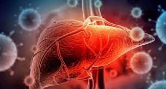 hepatitis