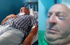 agresion periodista