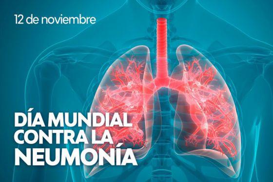 79063-se-recomienda-no-subestimar-los-sintomas-de-una-neumonia