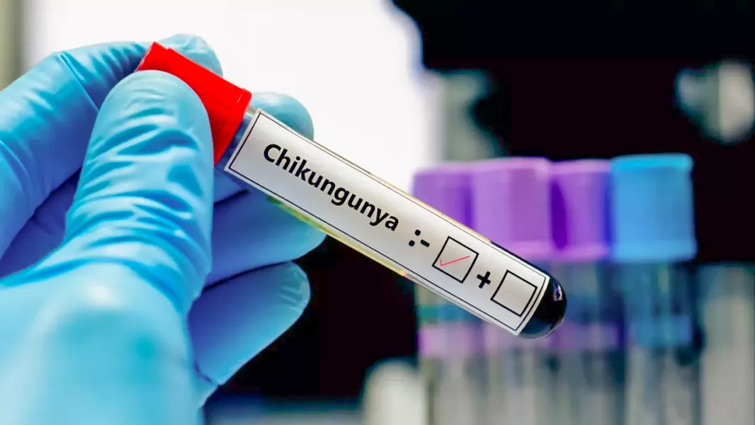 fiebre chikungunya