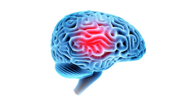 Cerebro-e1635452833712-768x407