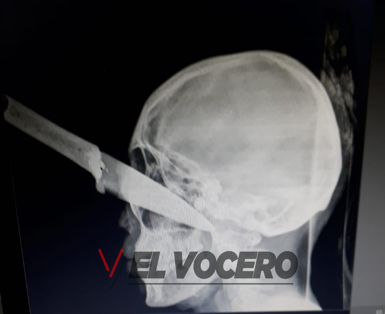 cuchillo