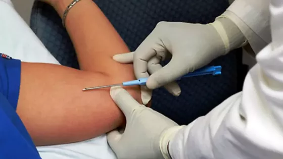 105323-salud-publica-realiza-la-colocacion-de-implantes-subdermicos