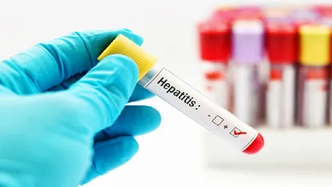 hepatitis-tipos-tratamiento