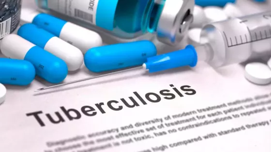 100743-en-el-anio-2024-se-diagnosticaron-967-nuevos-casos-de-tuberculosis-en-salta