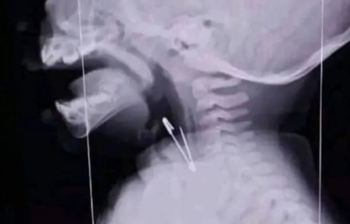 multimedia.normal.b778202183f5979c.bGcgKDE1KV9ub3JtYWwud2VicA==