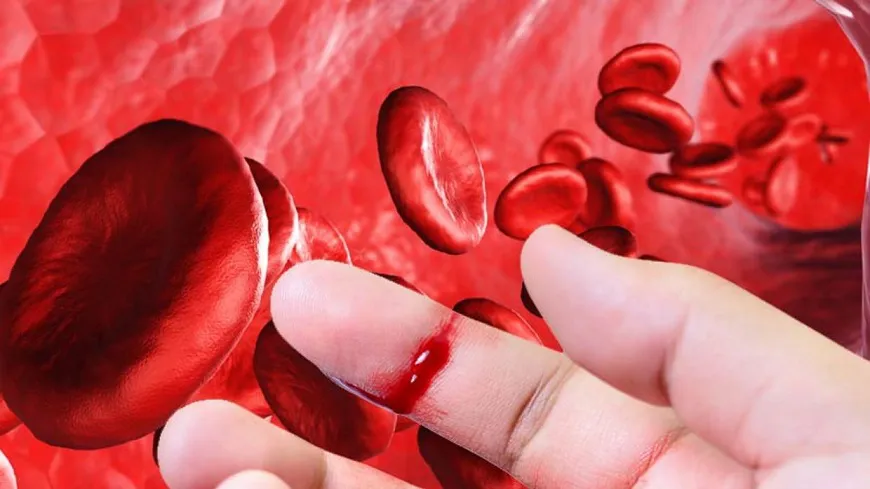 a6448a-cd47c4hemofilia