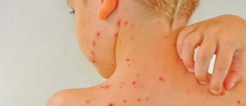 su_iei_810_by_350_rc