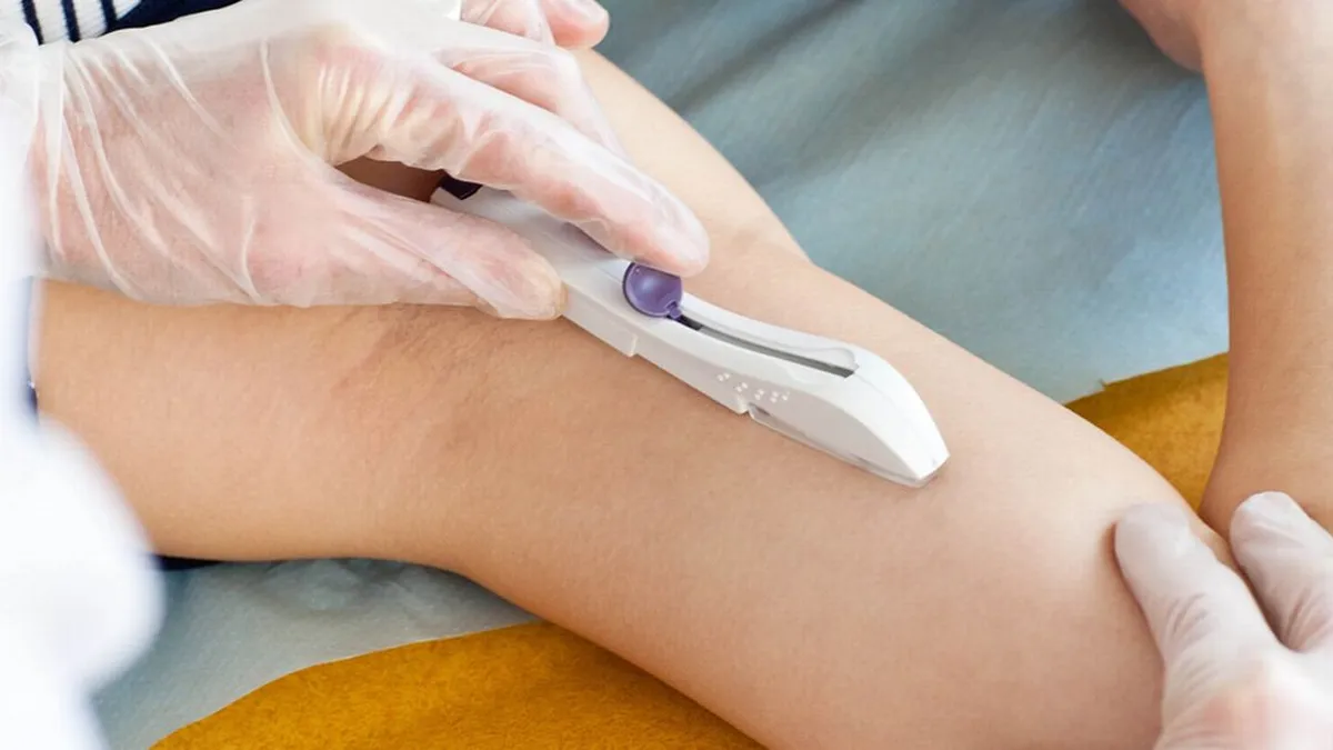 implante_subdermico2jpg